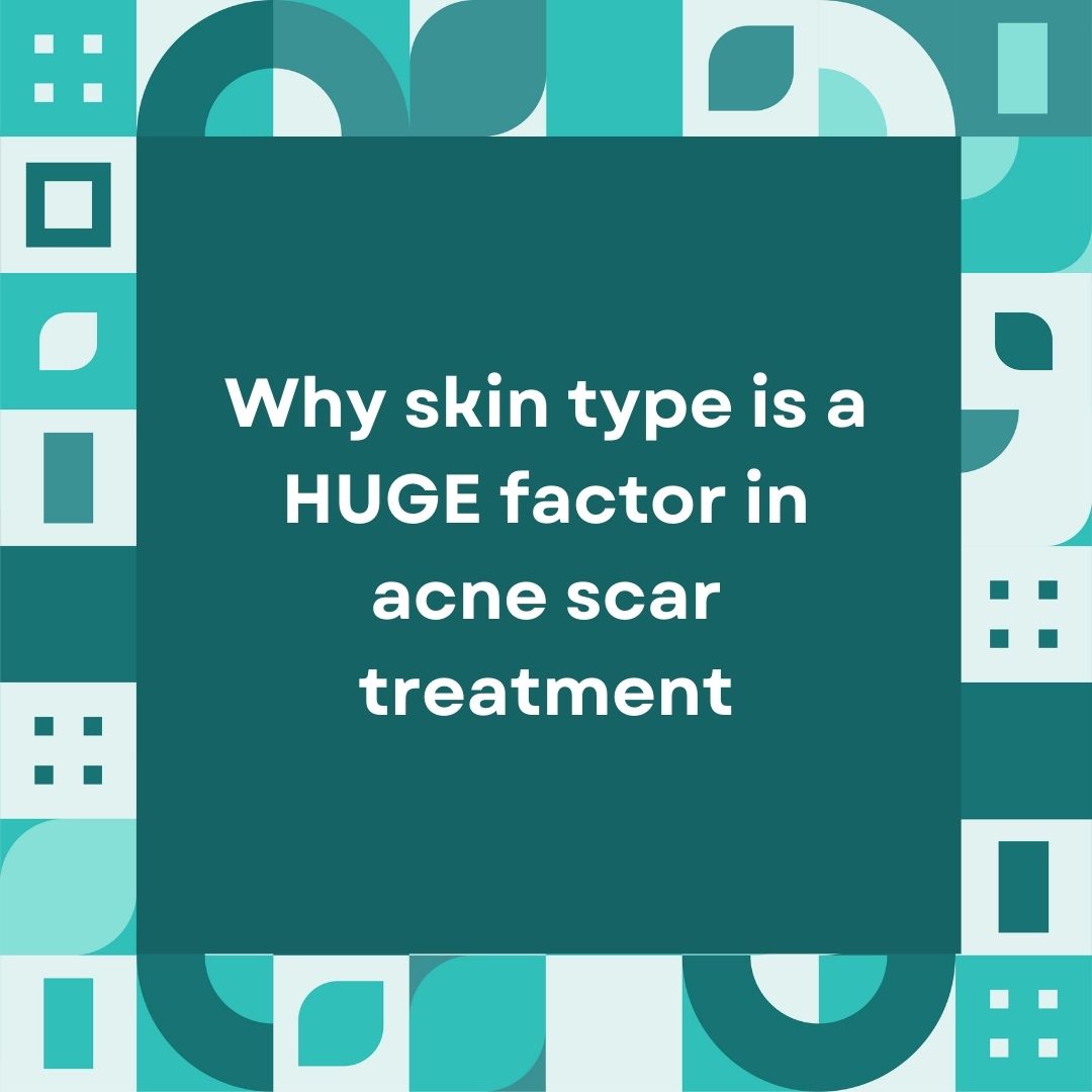 Why skin type is a HUGE factor in acne scar treatment
