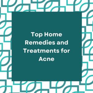 Top Home Remedies and Treatments for Acne