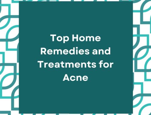 Top Home Remedies and Treatments for Acne