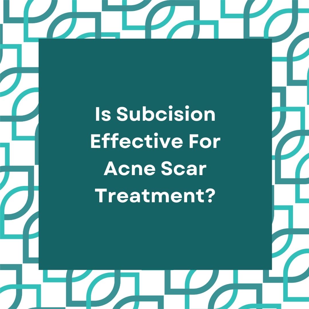 Is Subcision Effective For Acne Scar Treatment?