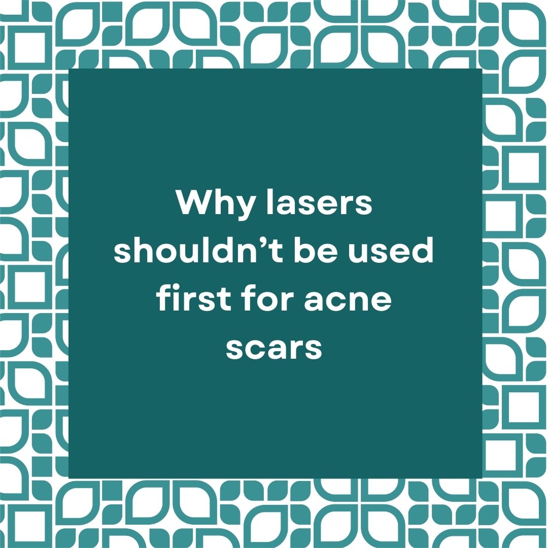 Why lasers shouldn’t be used first for acne scars