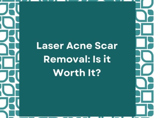 Laser Acne Scar Removal: Is it Worth It?