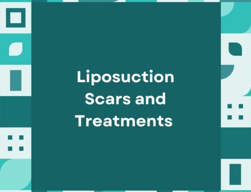 Liposuction Scars and Treatments