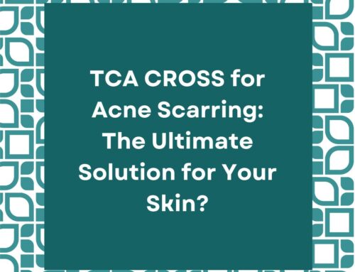 TCA CROSS for Acne Scarring: The Ultimate Solution for Your Skin?