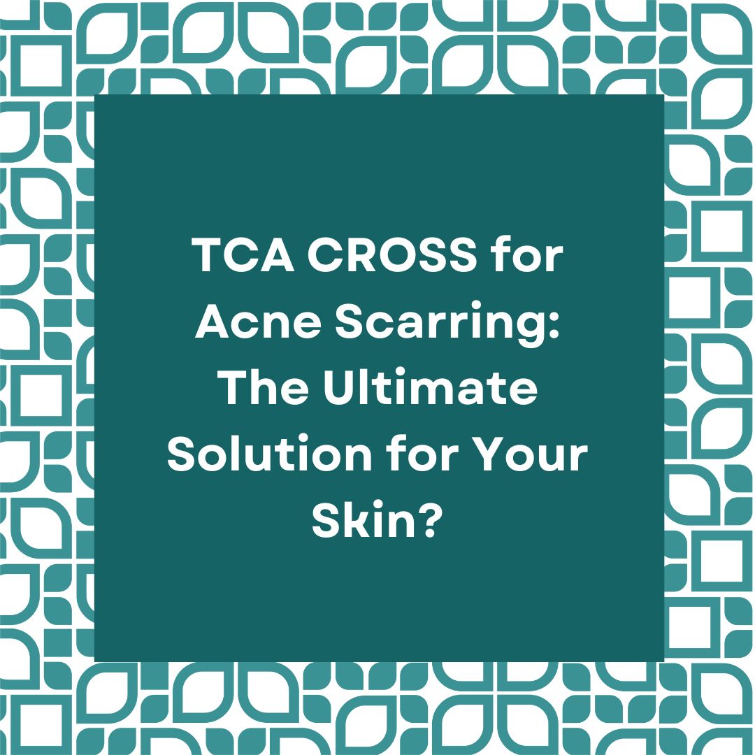 TCA CROSS for Acne Scarring: The Ultimate Solution for Your Skin?