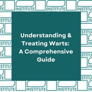 Understanding and Treating Warts: A comprehensive guide