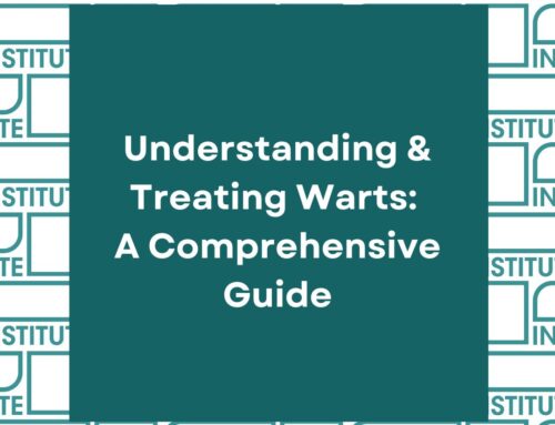 Understanding and Treating Warts: A Comprehensive Guide
