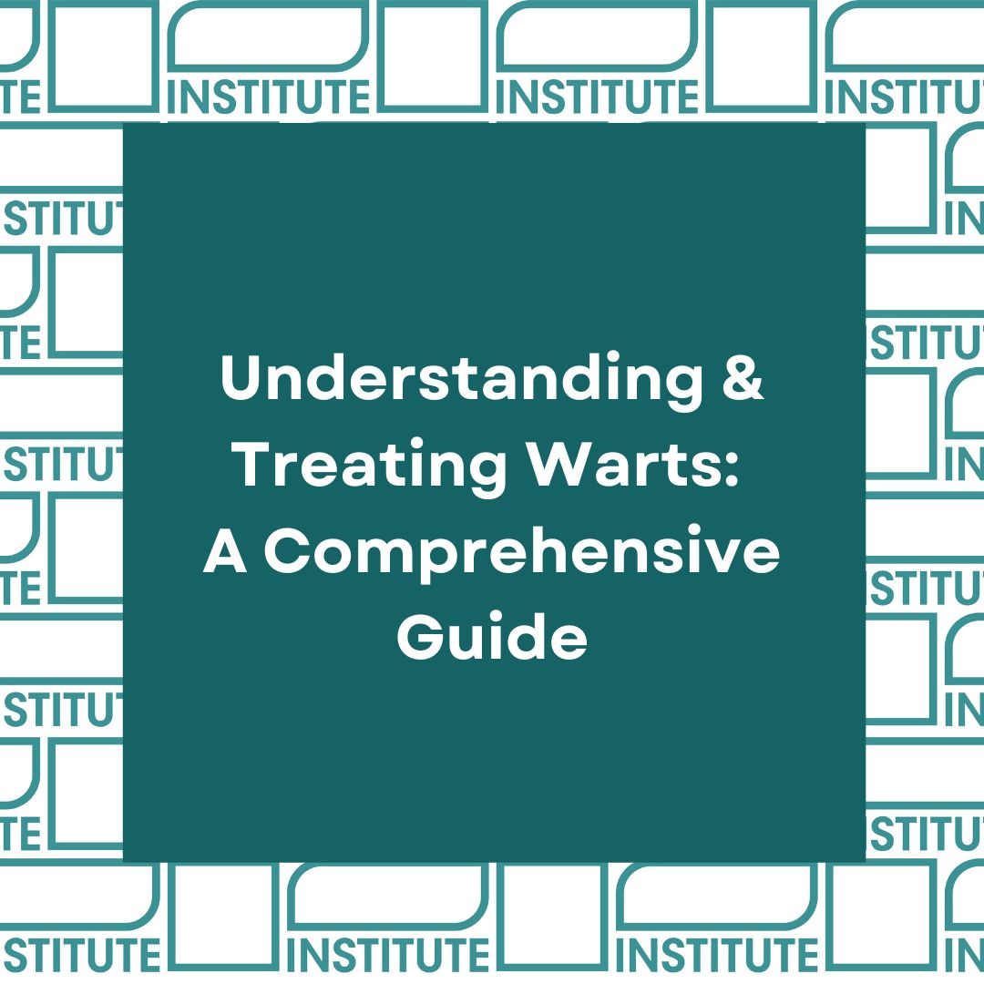 Understanding and Treating Warts: A comprehensive guide