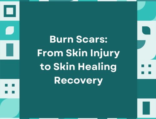 Burn Scars: From Skin Injury to Skin Healing Recovery