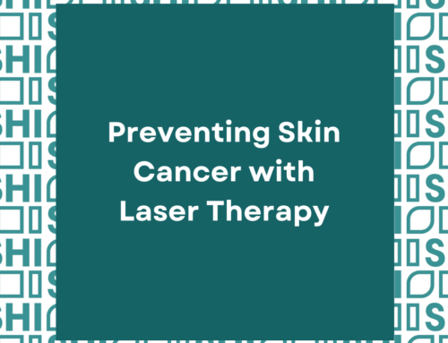 Preventing Skin Cancer with Laser Therapy