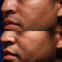 Before & After Before & After