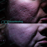 Before & After Before & After