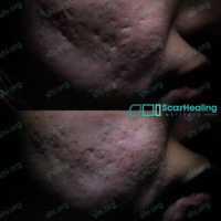 Before & After Before & After