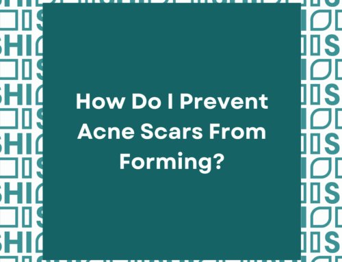 How Do I Prevent Acne Scars From Forming?