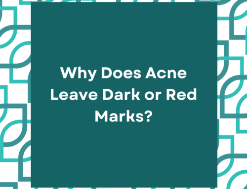 Why Does Acne Leave Dark or Red Marks?