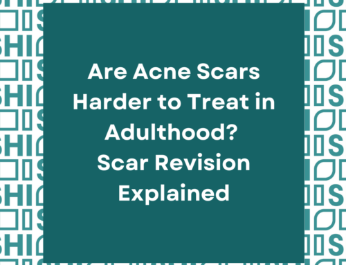 Are Acne Scars Harder to Treat in Adulthood? Scar Revision Explained