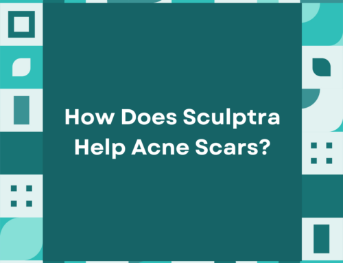 How Does Sculptra Help Acne Scars?