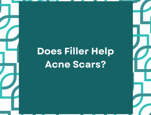 Does Filler Help Acne Scars?