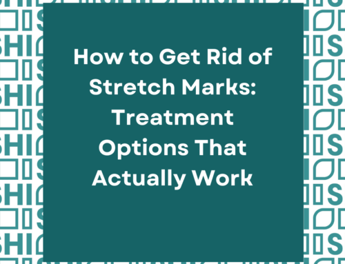 How to Get Rid of Stretch Marks: Treatment Options That Actually Work